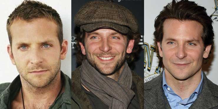 Bradley Cooper Plastic Surgery Before and After 2022