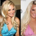 Bridget Marquardt Plastic Surgery