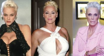 Brigitte Nielsen Plastic Surgery