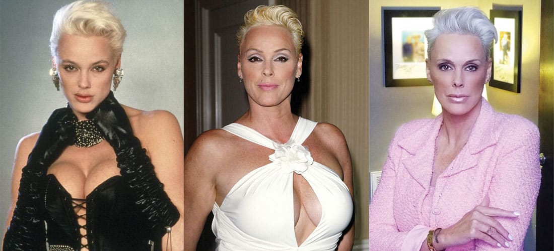 Brigitte Nielsen Plastic Surgery Before and After 2024