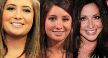 Bristol Palin Plastic Surgery
