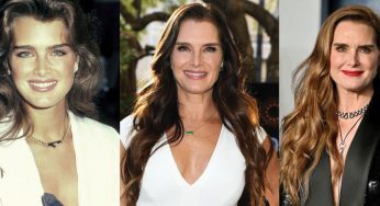 Brooke Shields Plastic Surgery