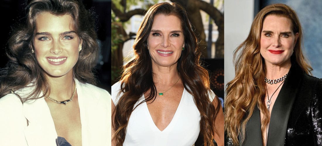 Brooke Shields Plastic Surgery Before and After 2024
