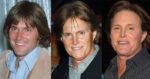 Bruce Jenner Plastic Surgery