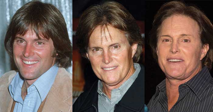 bruce jenner plastic surgery