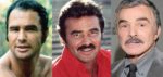 Burt Reynolds Plastic Surgery