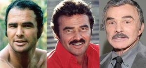 burt reynolds plastic surgery