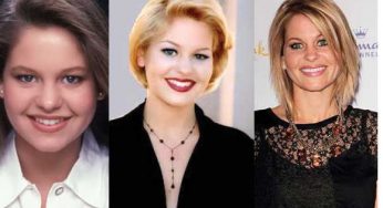 Candace Cameron Plastic Surgery
