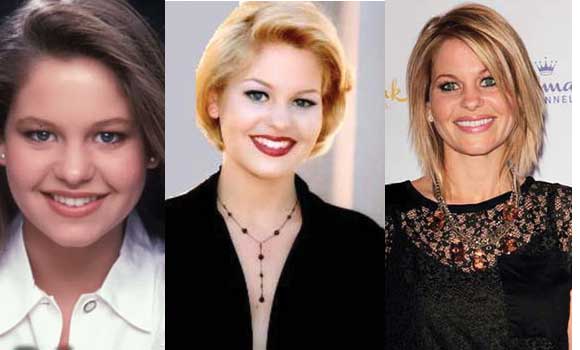 Candace Cameron Plastic Surgery Before and After 2022