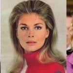 Candice Bergen Plastic Surgery