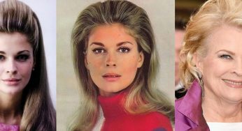 Candice Bergen Plastic Surgery