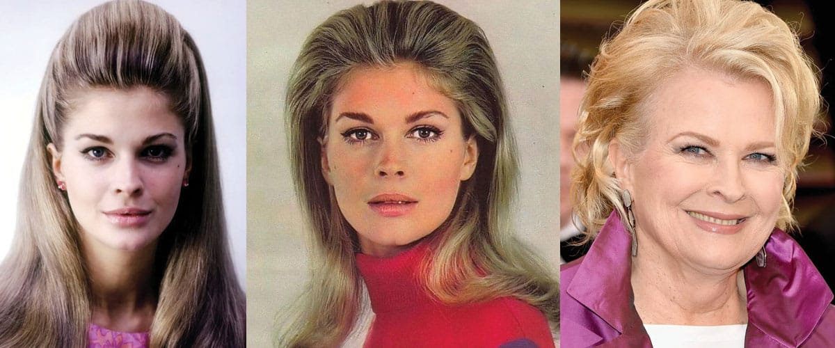Candice Bergen Plastic Surgery Before and After 2024
