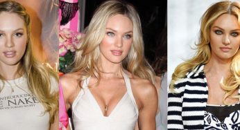 Candice Swanepoel Plastic Surgery
