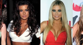 Carmen Electra Plastic Surgery