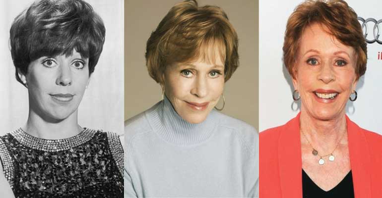 Carol Burnett Plastic Surgery Before and After 2024