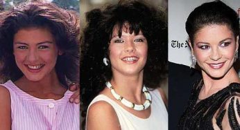 Catherine Zeta Jones Plastic Surgery