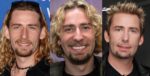 Chad Kroeger Plastic Surgery