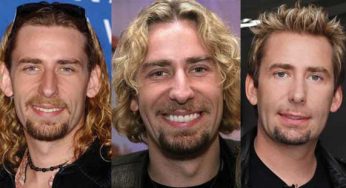 Chad Kroeger Plastic Surgery