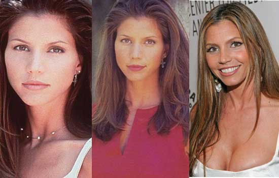 charisma carpenter plastic surgery