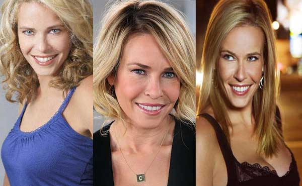 Chelsea Handler Plastic Surgery Before and After 2022