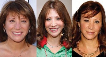 Cheri Oteri Plastic Surgery