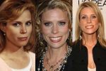 Cheryl Hines Plastic Surgery