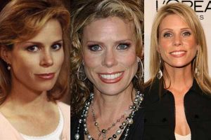 cheryl hines plastic surgery