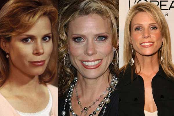 cheryl hines plastic surgery