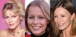 Cheryl Ladd Plastic Surgery