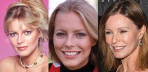 cheryl ladd plastic surgery