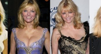 Cheryl Tiegs Plastic Surgery