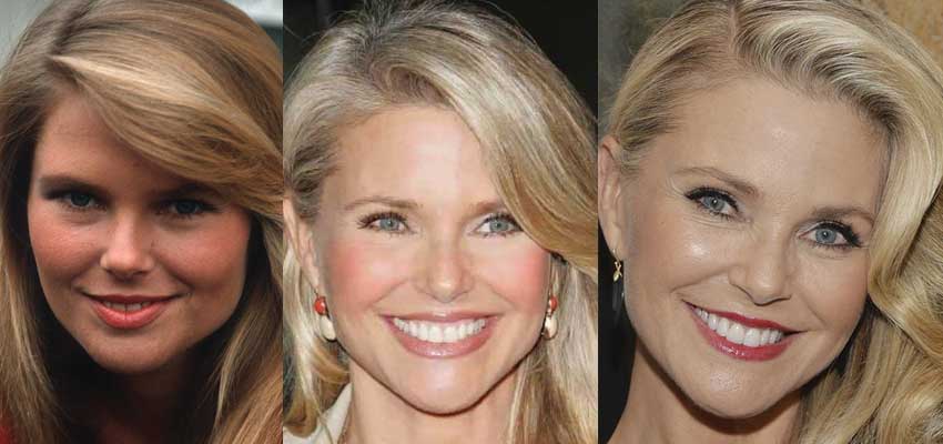 Christie Brinkley Plastic Surgery Before and After 2022