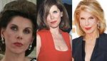 Christine Baranski Plastic Surgery