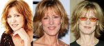 Christine Lahti Plastic Surgery