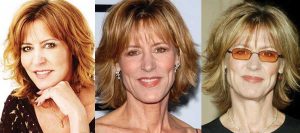 christine lahti plastic surgery