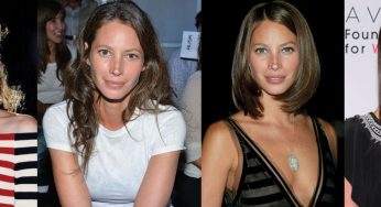 Christy Turlington Plastic Surgery