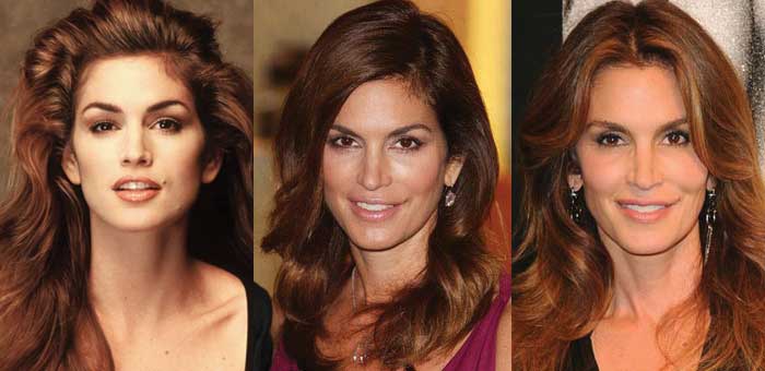 Cindy Crawford Plastic Surgery Before and After 2023