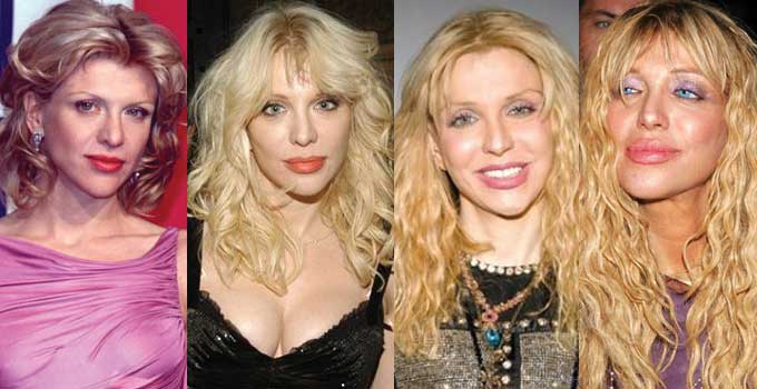 Courtney Love Plastic Surgery Before and After 2023