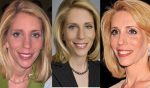 Dana Bash Plastic Surgery