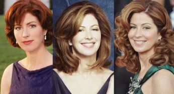 Dana Delany Plastic Surgery