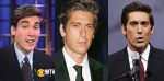 David Muir Plastic Surgery