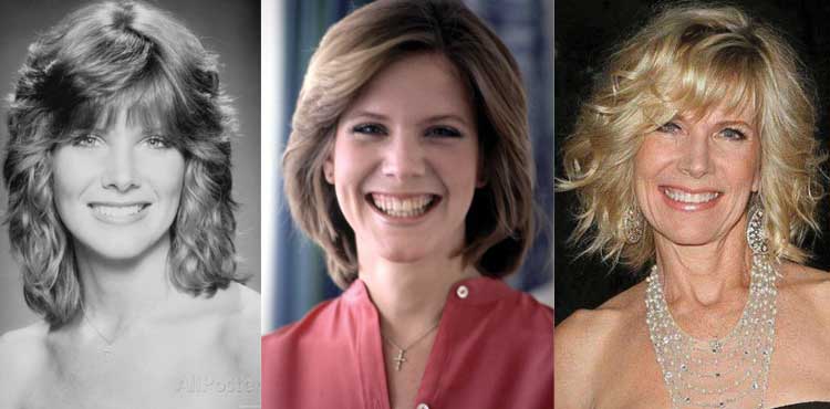 Debby Boone Plastic Surgery Before and After 2022