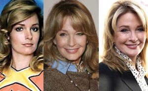 deidre hall plastic surgery