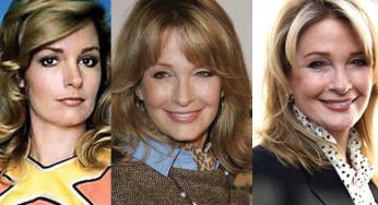 Deidre Hall Plastic Surgery