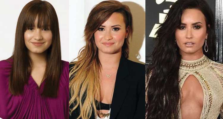 Demi Lovato Plastic Surgery Before and After 2023