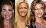 Denise Richards Plastic Surgery