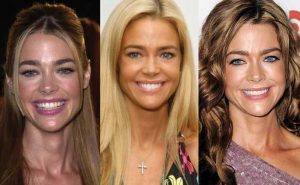 denise richards plastic surgery