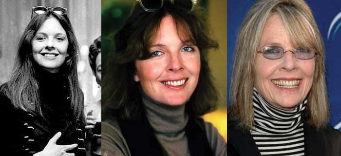 diane keaton plastic surgery