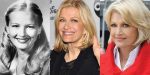 Diane Sawyer Plastic Surgery