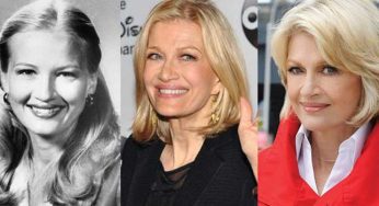 Diane Sawyer Plastic Surgery